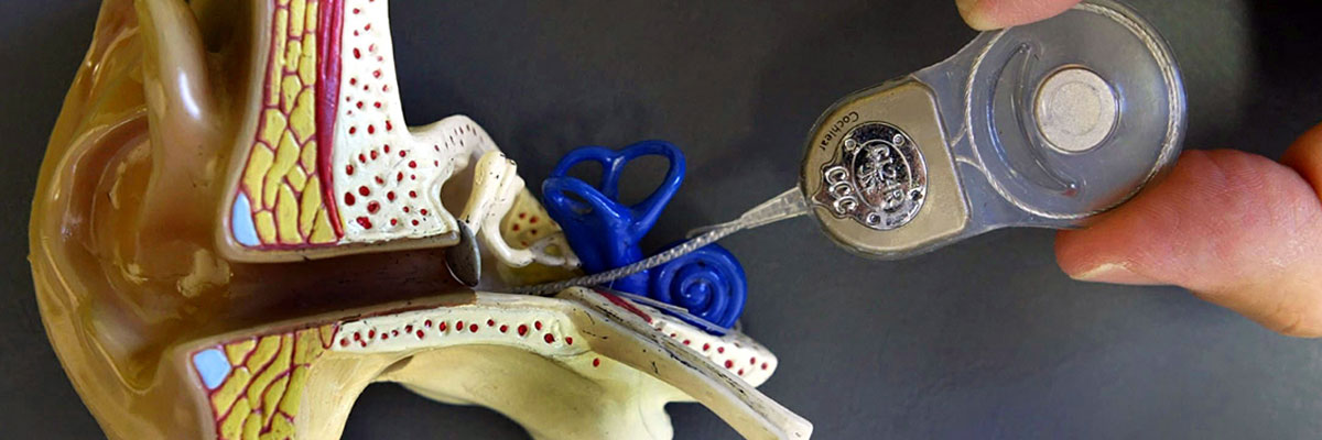 Hearing Implantology