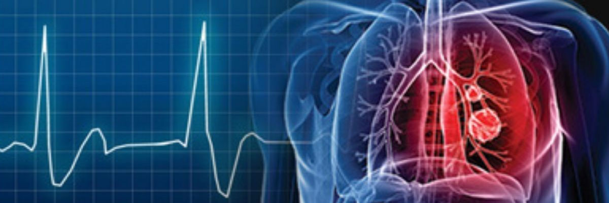 EP Study and Radiofrequency Ablation